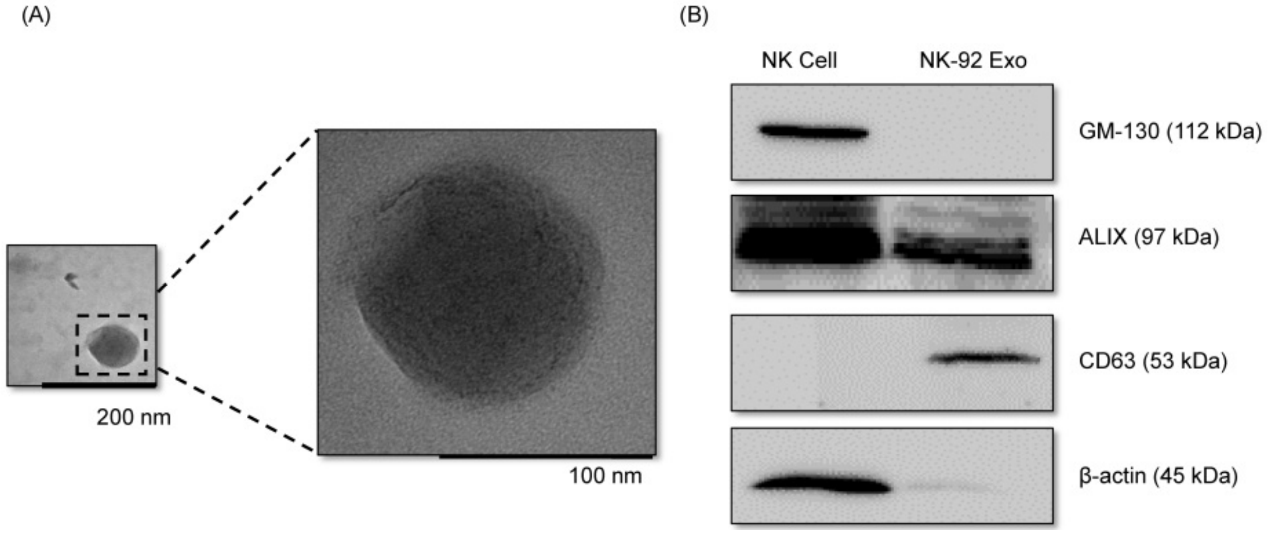 Exosome isolation verified by TEM imaging and Western blot detection of CD63 and ALIX markers from NK-92MI cells.